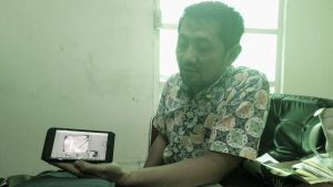 Ini Fasilitas di Ruang Operasi RS Andi Makkasau Parepare